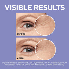 L'Oreal Paris Revitalift Derm Intensives® 2.5% Hyaluronic Acid + Caffeine Eye Serum