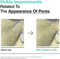 Anua BHA 2% Gentle Exfoliating Toner