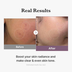 Medicube Age-R Glutathione Glow Toner