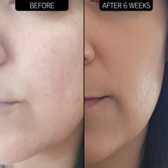 The Inkey List Dry and Rough Skin Solution with 10% Urea Moisturizer