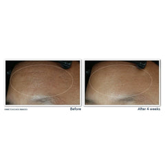 RETINOL CORREXION® Line Smoothing Max Hydration