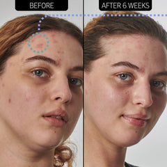 The Inkey List Dry and Rough Skin Solution with 10% Urea Moisturizer