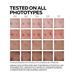 La Roche-Posay Effaclar Duo+M Triple Correction