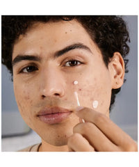Neutrogena Stubborn Acne™ Spot Drying Lotion