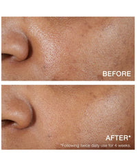Neutrogena Hydro Boost Hyaluronic Acid Serum