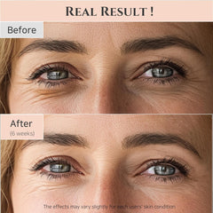 https://www.skinhub.pk/products/beauty-of-joseon-revive-eye-serum-ginseng-retinal