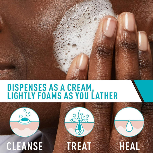 https://buraki.pk/products/cerave-acne-foaming-cream-cleanser-benzoyl-peroxide-acne-treatment-150ml