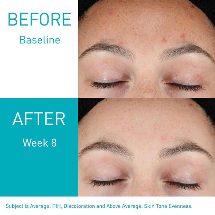 https://buraki.pk/products/cerave-resurfacing-retinol-serum