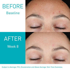 https://buraki.pk/products/cerave-resurfacing-retinol-serum