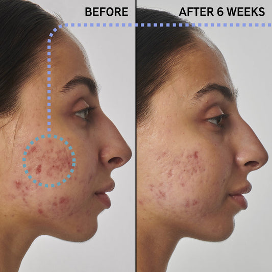 The Inkey List Super Solutions 1% Retinol Serum
